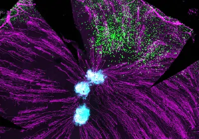 Microscopic image of nerves in the eye, a pathogen, and t cells